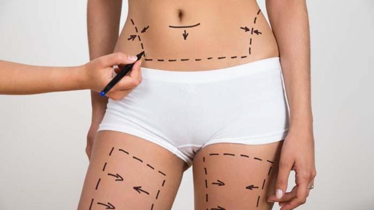 661a9613a62a08cf17a4548b