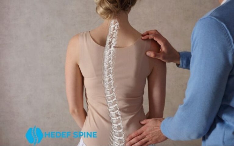 Skolyoz Tedavisinde Skolyoz Korsesi Neden Önemli