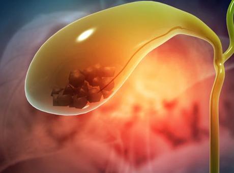 69679e9f2c06cab90313bfea